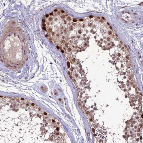 Immunohistochemistry-Paraffin: DIS3 Antibody [NBP1-85209] -Staining of human testis shows strong nuclear positivity in cells in seminiferous ducts.