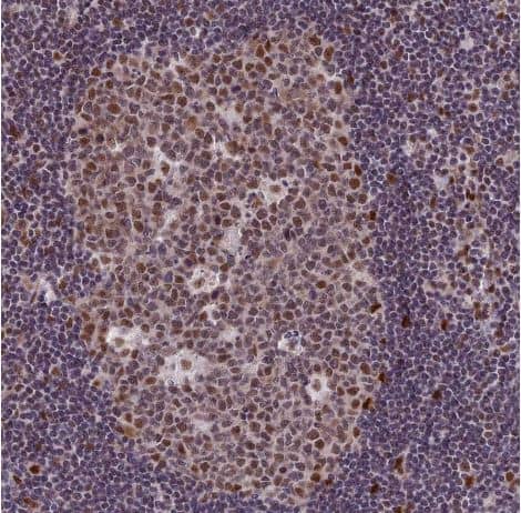 Immunohistochemistry-Paraffin: DIS3 Antibody [NBP1-85209] - Staining of human lymph node shows strong nuclear positivity in germinal center cells.