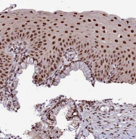 Immunohistochemistry-Paraffin: DIS3 Antibody [NBP1-85209] - Staining of human cervix shows strong nuclear positivity in squamous epithelial cells.