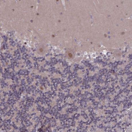 Immunohistochemistry-Paraffin: DIS3 Antibody [NBP1-85209] - Staining of human cerebellum shows moderate nuclear positivity in Purkinje cells. 