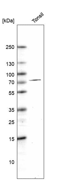 Analysis in human tonsil tissue.