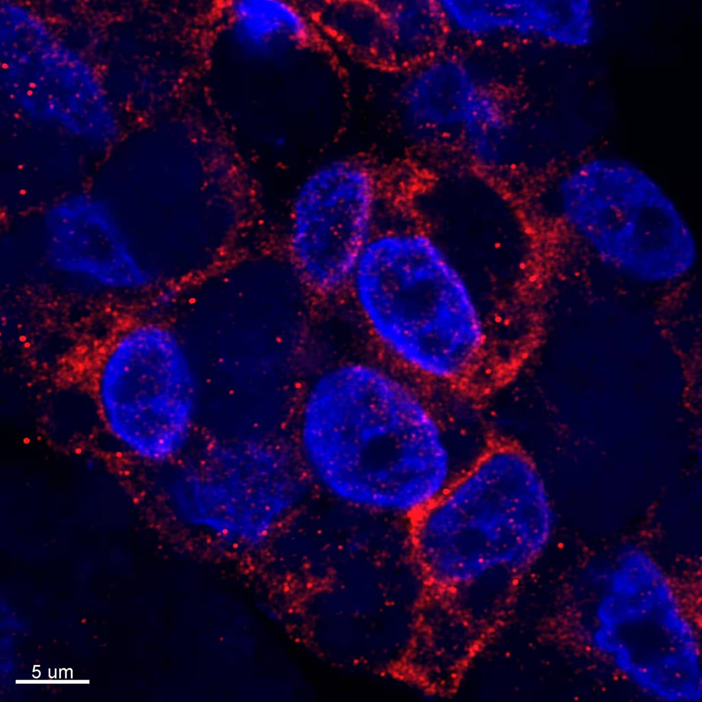 Immunocytochemistry/Immunofluorescence: Rabbit Polyclonal Cytochrome P450 2E1 Antibody [NBP1-85367] - VA-13 cells (mouse ADH1-transfected HepG2 cells) stained with Cytochrome P450 2E1 Antibody. Image from a verified customer review.