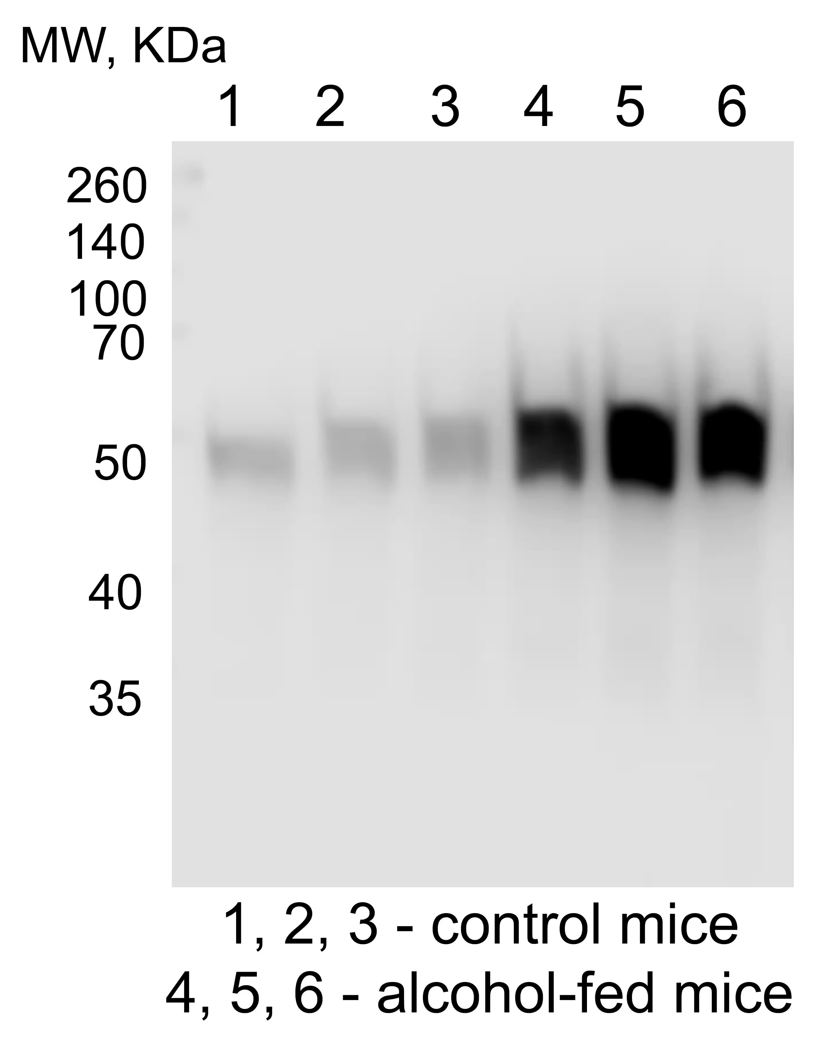 Western Blot: Rabbit Polyclonal Cytochrome P450 2E1 Antibody [NBP1-85367] - Western Blot of the liver homogenates from control and alcohol-fed mice. Image from a verified customer review.