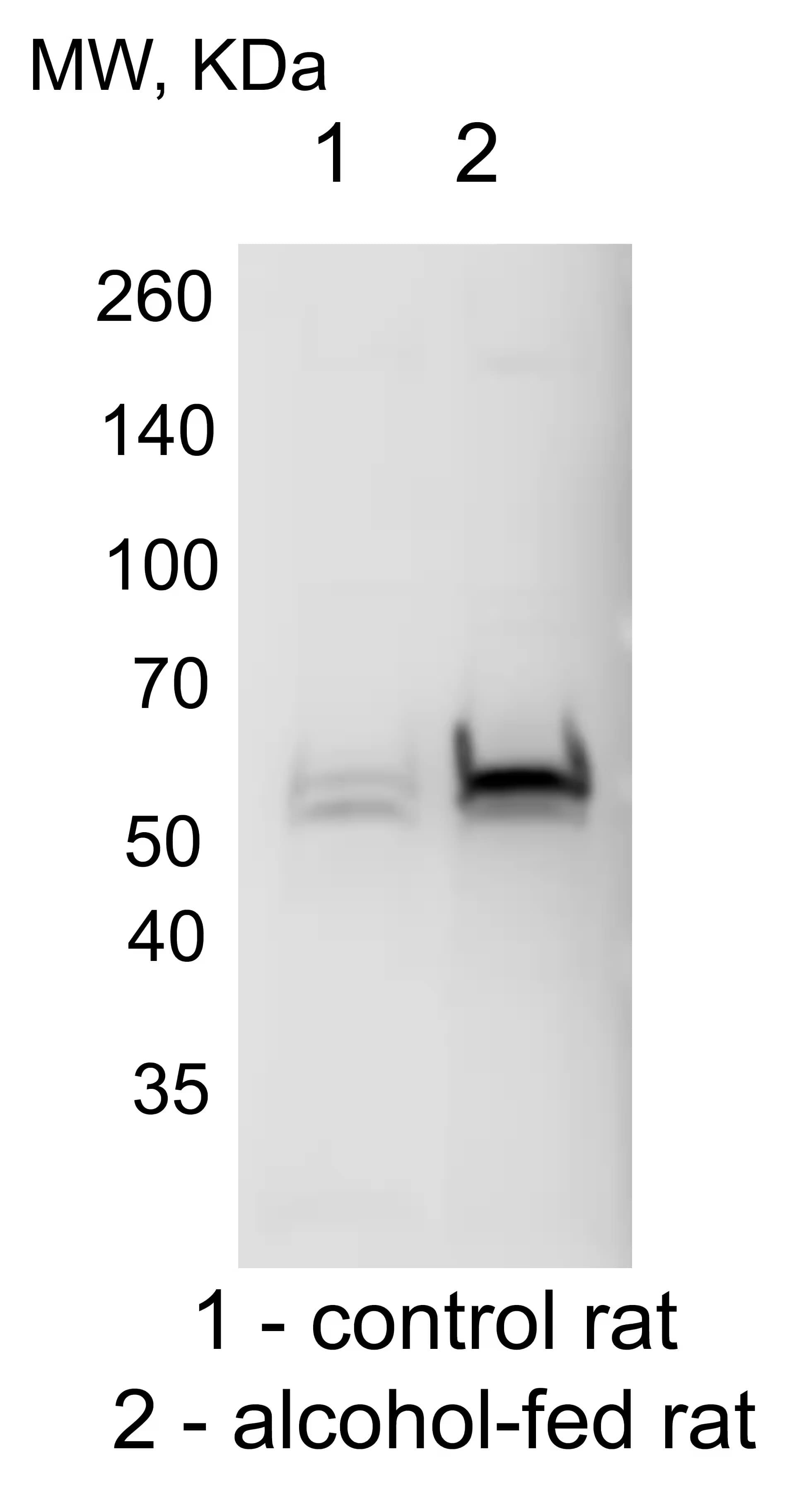 Western Blot: Rabbit Polyclonal Cytochrome P450 2E1 Antibody [NBP1-85367] - Cytochrome P450 2E1 western blot of the homogenates from control and alcohol-fed rats. Image from a verified customer review.