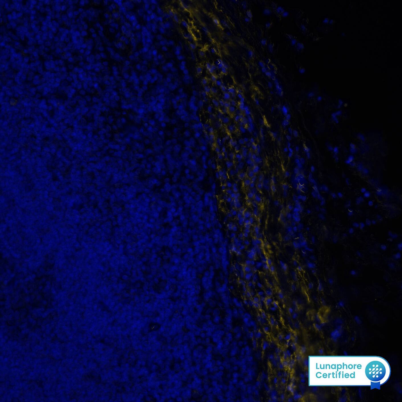 Versican was detected in immersion fixed paraffin-embedded sections of human Lymph Node using Rabbit Anti-Human/Mouse Versican, Polyclonal Antibody (Catalog # NBP1-85432) at 10ug/mL at 37° Celsius for 8 minutes. Before incubation with the primary antibody, tissue underwent an all-in-one dewaxing and antigen retrieval preprocessing using PreTreatment Module (PT Module) and Dewax and HIER Buffer H (pH 9; Epredia Catalog # TA-999-DHBH). Tissue was stained using the Alexa Fluor™ Plus 555 Goat anti-Rabbit IgG Secondary Antibody at 1:100 at 37 ° Celsius for 2 minutes. (Yellow; Lunaphore Catalog # DR555RB) and counterstained with DAPI (blue; Lunaphore Catalog # DR100). Specific staining was localized to the cytoplasm of connective tissue/stroma. Protocol available in COMET™ Panel Builder.