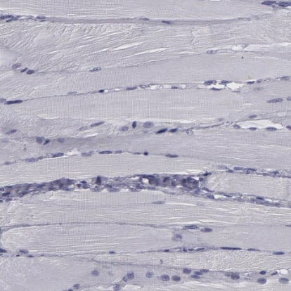  Staining of human skeletal muscle shows no positivity in myocytes as expected.