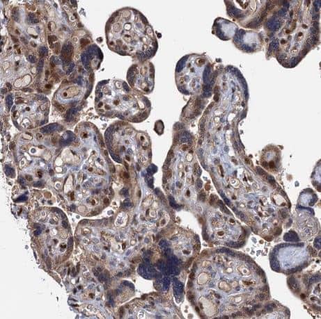 Immunohistochemistry-Paraffin: UBLCP1 Antibody [NBP1-85468] -Staining of human placenta shows moderate nuclear positivity in trophoblastic cells. 