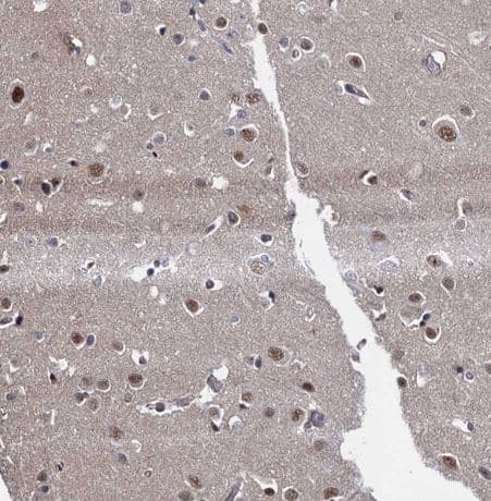 Immunohistochemistry-Paraffin: UBLCP1 Antibody [NBP1-85468] -Staining of human cerebral cortex shows moderate nuclear positivity in neurons.