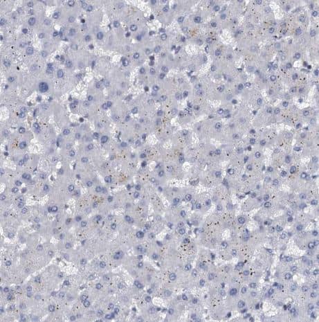 Immunohistochemistry-Paraffin: UBLCP1 Antibody [NBP1-85468] -Staining of human liver shows no nuclear positivity in hepatocytes.