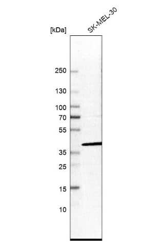 Western Blot: UBLCP1 Antibody [NBP1-85468] -Analysis in human cell line SK-MEL-30.