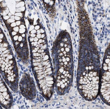 Immunohistochemistry-Paraffin: TBRG4 Antibody [NBP1-85478] -Staining of human colon shows strong granular cytoplasmic positivity in glandular cells.