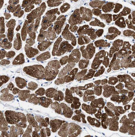 Immunohistochemistry-Paraffin: TBRG4 Antibody [NBP1-85478] -Staining of human heart muscle shows strong granular cytoplasmic positivity in cardiomyoctes.