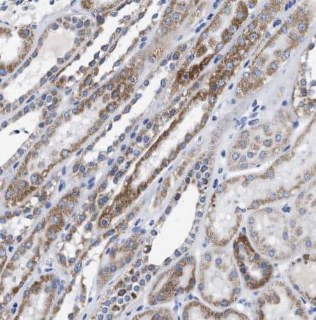 Immunohistochemistry-Paraffin: TBRG4 Antibody [NBP1-85478] -Staining of human kidney shows moderate granular cytoplasmic positivity in cells in tubules. 