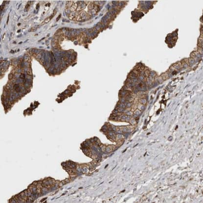 Immunohistochemistry-Paraffin ADCK4 Antibody - BSA Free