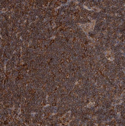 Immunohistochemistry-Paraffin ADCK4 Antibody - BSA Free