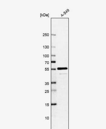 Western Blot ADCK4 Antibody - BSA Free