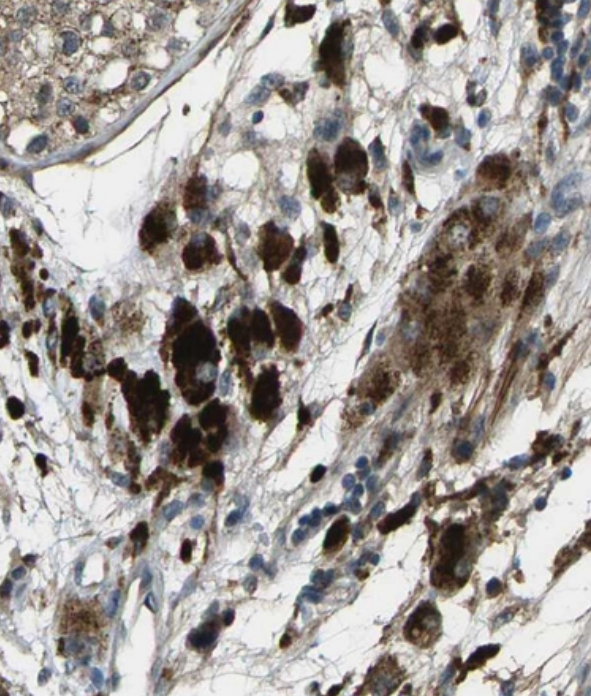 Staining of human testis shows strong cytoplasmic positivity in Leydig cells.