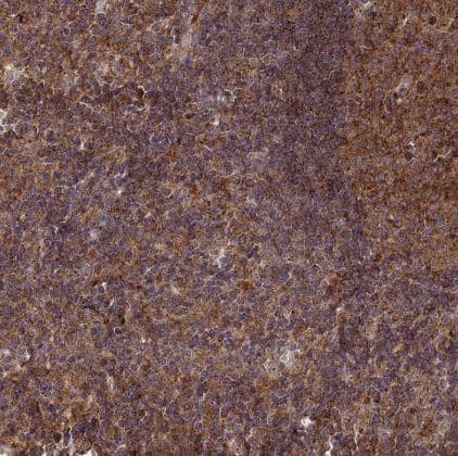 Immunohistochemistry-Paraffin: Clathrin interactor 1 Antibody [NBP1-85570] - Staining of human lymph node shows strong cytoplasmic positivity in non-germinal center cells.