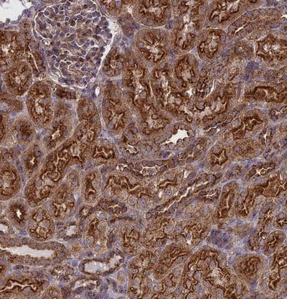 Immunohistochemistry-Paraffin: Clathrin interactor 1 Antibody [NBP1-85570] -Staining of human kidney shows strong cytoplasmic/ membranous positivity in cells in tubules.