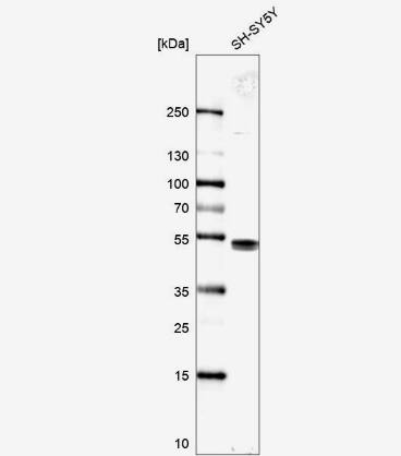 Western Blot: LDB1 Antibody [NBP1-85573] -Analysis in human cell line SH-SY5Y.