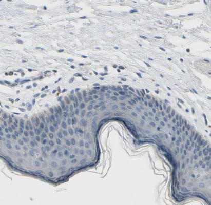 Immunohistochemistry-Paraffin: CD23/Fc epsilon RII Antibody [NBP1-85776] - Staining of human skin shows no positivity in squamous epithelial cells as expected.