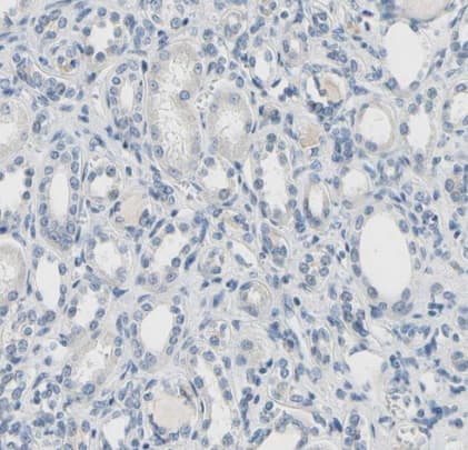 Immunohistochemistry-Paraffin: CD23/Fc epsilon RII Antibody [NBP1-85776] - Staining of human kidney shows no positivity in cells in tubules as expected.