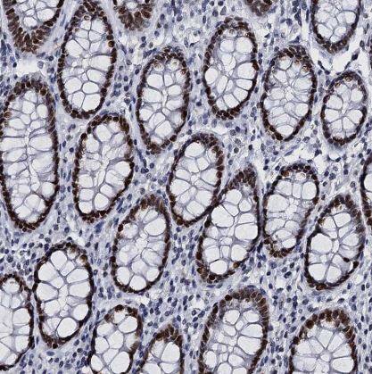 Immunohistochemistry-Paraffin: CMAS Antibody [NBP1-85858] -Staining of human colon shows strong nuclear positivity in glandular cells.