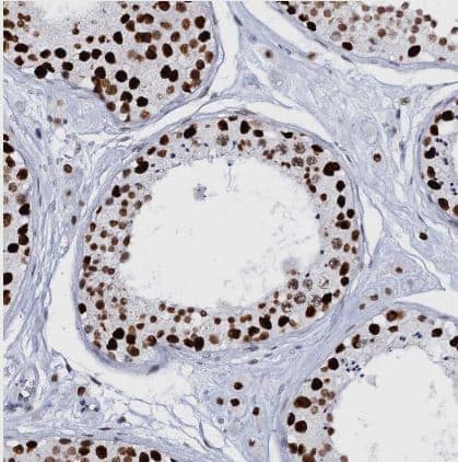 Immunohistochemistry-Paraffin: CMAS Antibody [NBP1-85858] - Staining of human testis shows strong nuclear positivity in cells in seminiferous ducts.