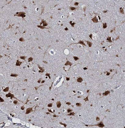 Immunohistochemistry-Paraffin: CMAS Antibody [NBP1-85858] -Staining of human cerebral cortex shows strong nuclear positivity in neurons.