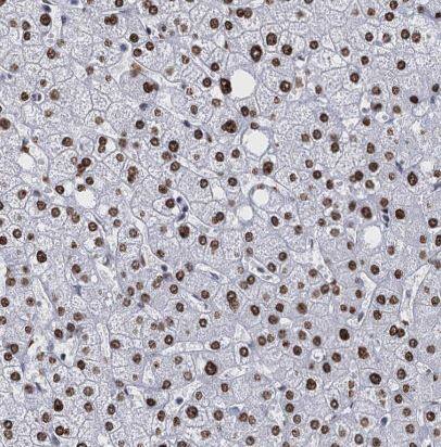 Immunohistochemistry-Paraffin: CMAS Antibody [NBP1-85858] -Staining of human liver shows strong nuclear positivity in hepatocytes.