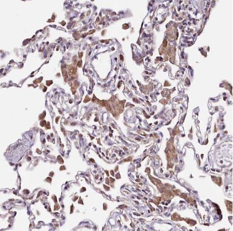 Immunohistochemistry-Paraffin: ATE1 Antibody [NBP1-85872] -Staining of human lung shows strong cytoplasmic positivity in macrophages.