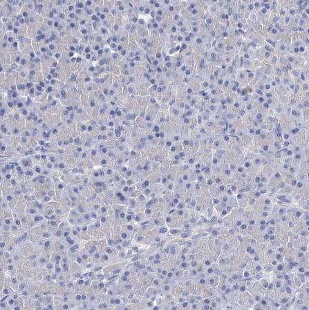 Staining of human pancreas shows no positivity in exocrine glandular cells as expected.