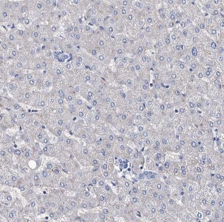 Staining of human liver shows no positivity in hepatocytes as expected. 