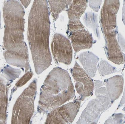 Immunohistochemistry-Paraffin: Carbonic Anhydrase VB/CA5B Antibody [NBP1-86090] -Staining of human skeletal muscle shows moderate cytoplasmic positivity in myocytes.