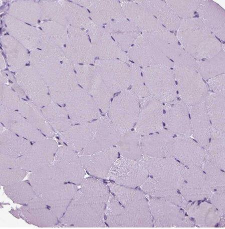 Immunohistochemistry-Paraffin: RFX3 Antibody [NBP1-86301] -Staining of human skeletal muscle shows no positivity in myocytes as expected.