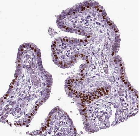 Immunohistochemistry-Paraffin: RFX3 Antibody [NBP1-86301] -Staining of human fallopian tube shows moderate nuclear positivity in glandular cells. 