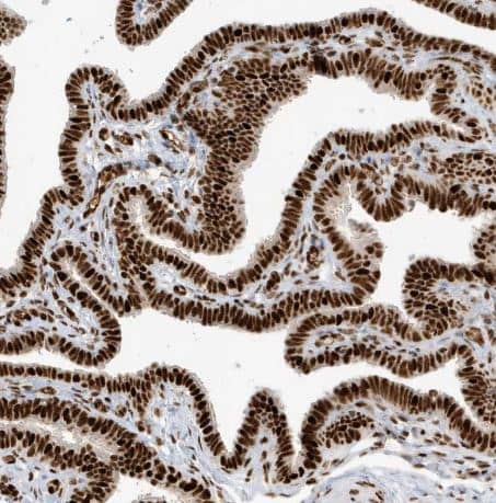 Immunohistochemistry-Paraffin: CKS2 Antibody [NBP1-86336] - Staining of human fallopian tube shows strong nuclear positivity in glandular cells.