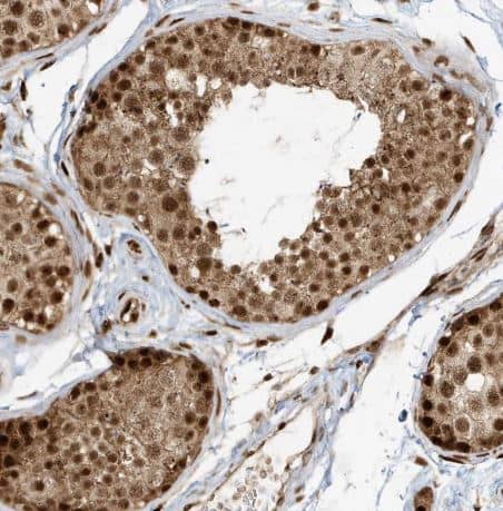 Immunohistochemistry-Paraffin: CKS2 Antibody [NBP1-86336] - Staining of human testis shows strong nuclear positivity in cells in seminiferous ducts.