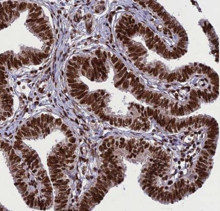 Immunohistochemistry-Paraffin: INO80E Antibody [NBP1-86578] - Staining of human fallopian tube shows strong nuclear positivity in glandular cells.
