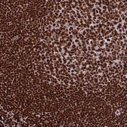 Immunohistochemistry-Paraffin: INO80E Antibody [NBP1-86578] -  Staining of human tonsil shows strong nuclear positivity in germinal and non germinal center cells.