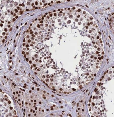 Immunohistochemistry-Paraffin: INO80E Antibody [NBP1-86578] - Staining of human testis shows strong nuclear positivity in cells in seminiferous ducts and leydig cells.