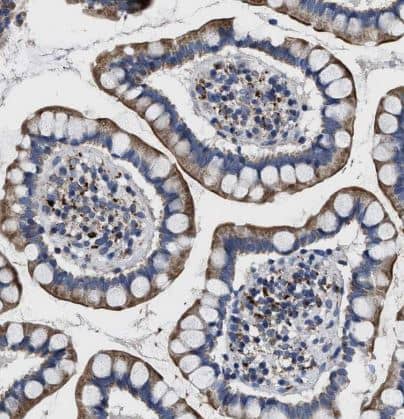 Immunohistochemistry-Paraffin: Cav1.3 Antibody [NBP1-86684] - Staining of human small intestine shows strong cytoplasmic positivity in glandular cells.