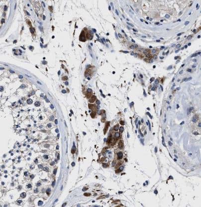 Immunohistochemistry-Paraffin: Cav1.3 Antibody [NBP1-86684] - Staining of human testis shows strong cytoplasmic positivity in Leydig cells.