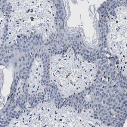 Immunohistochemistry-Paraffin: Cav1.3 Antibody [NBP1-86684] - Staining of human skin shows no cytoplasmic positivity in squamous epithelial cells as expected.