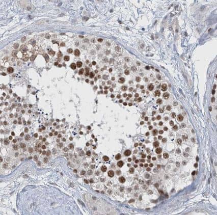 Immunohistochemistry-Paraffin MCM9 Antibody