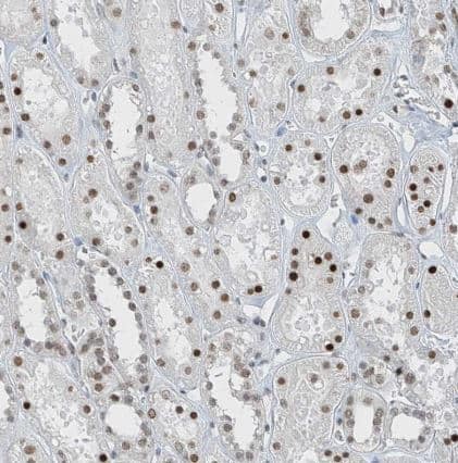 Immunohistochemistry-Paraffin MCM9 Antibody