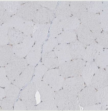 Immunohistochemistry-Paraffin MCM9 Antibody