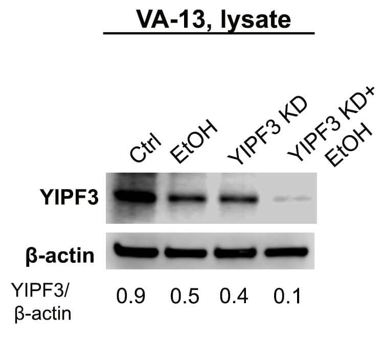 Western Blot: Rabbit Polyclonal YIPF3 Antibody [NBP1-86765] - YIPF3 W-B of the lysate VA-13 cells (mouse ADH1-transfected HepG2 cells): control, alcohol-treated. treated with YIPF3 siRNAs, and alcohol plus YIPF3 siRNAs. Beta-actin is a loading control. Image from a verified customer review.