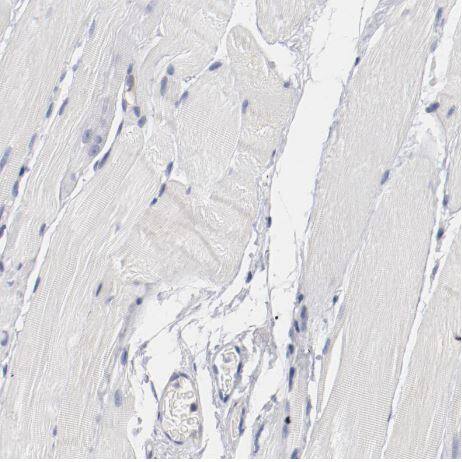 Immunohistochemistry-Paraffin: TSPAN6 Antibody [NBP1-86976] - Staining of human skeletal muscle shows negative membranous positivity in myocytes as expected.