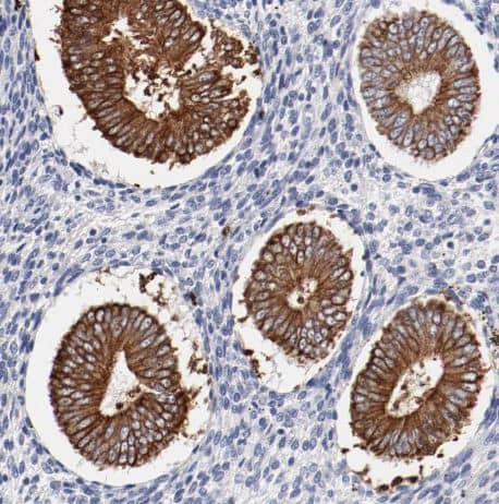 Immunohistochemistry-Paraffin: TSPAN6 Antibody [NBP1-86976] - Staining of human endometrium shows strong membranous positivity in glandular cells.